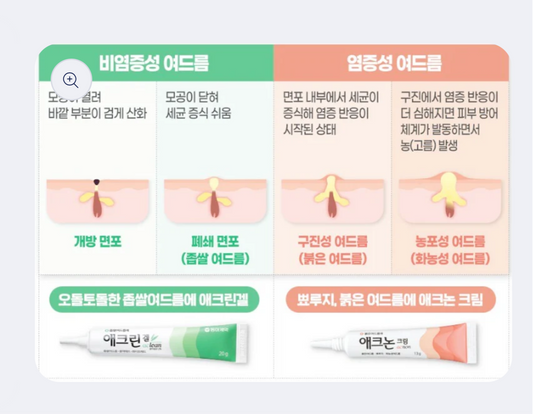 Aclean Gel - COMEDONAL ACNE TREATMENT GEL 20g 애크린 겔