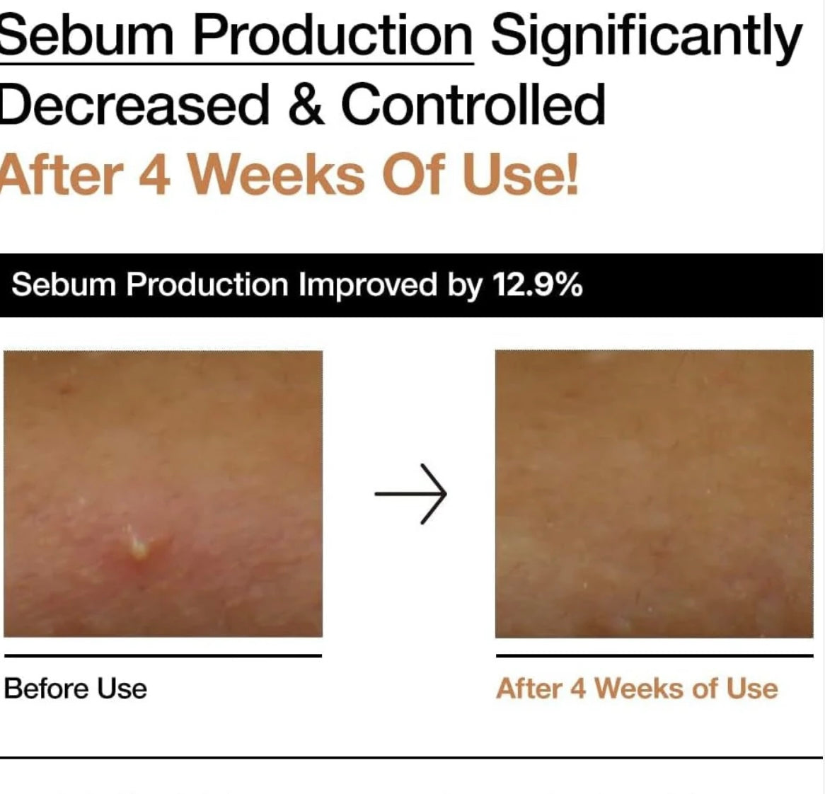 ANUA Rice 70 Glow Milky Toner