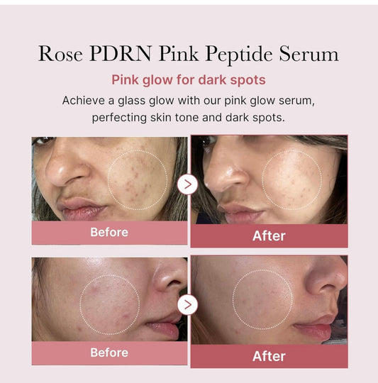 Medicube PdRn Pink Serum