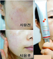 BeaUTE Melasma Cream